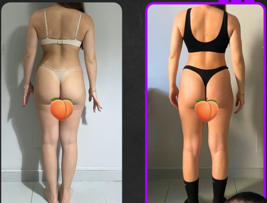 Prima e dopo: 12 settimane: alvo stitico e SIBO risolti, massa grassa ridotta e muscolo aumentato.