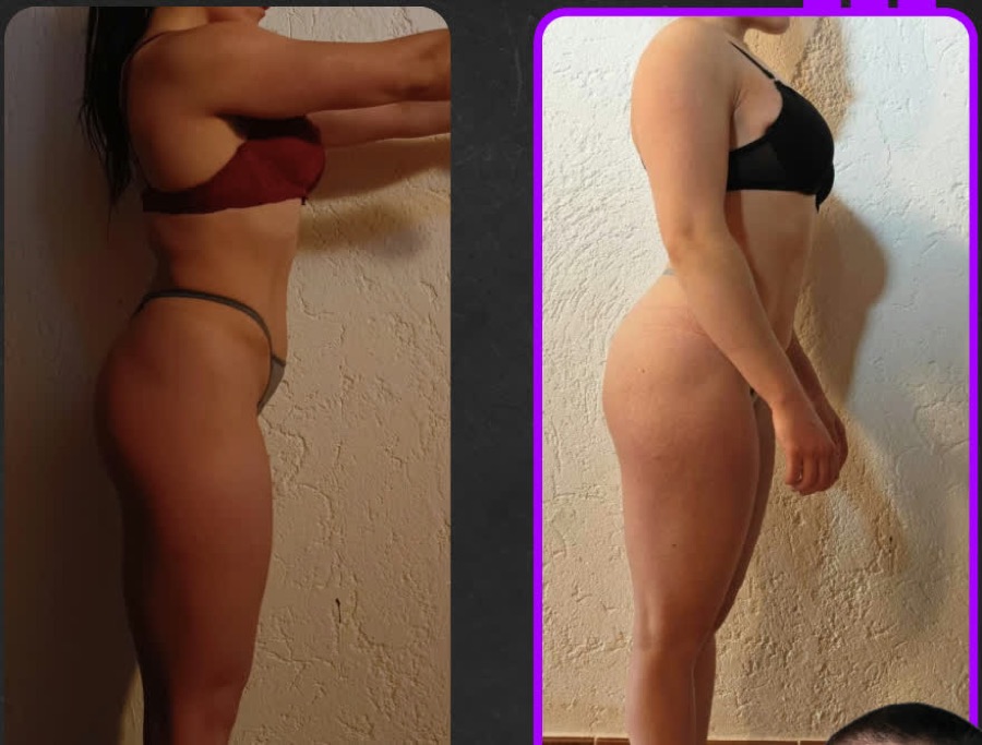 Prima e dopo: Un anno di percorso nutrizionale: svariati kg di muscolo, efficienza digestiva mantenuta, quasi 3000 kcal al giorno.