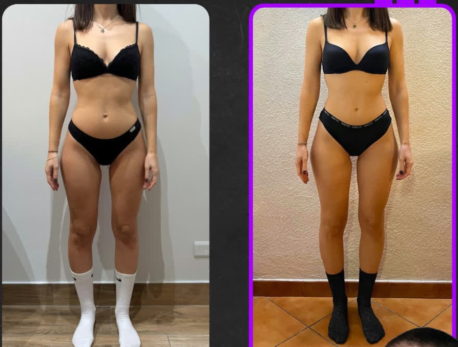 Prima e dopo: Percorso nutrizionale con focus sull'intestino: gonfiori cronici risolti e scariche eliminate.