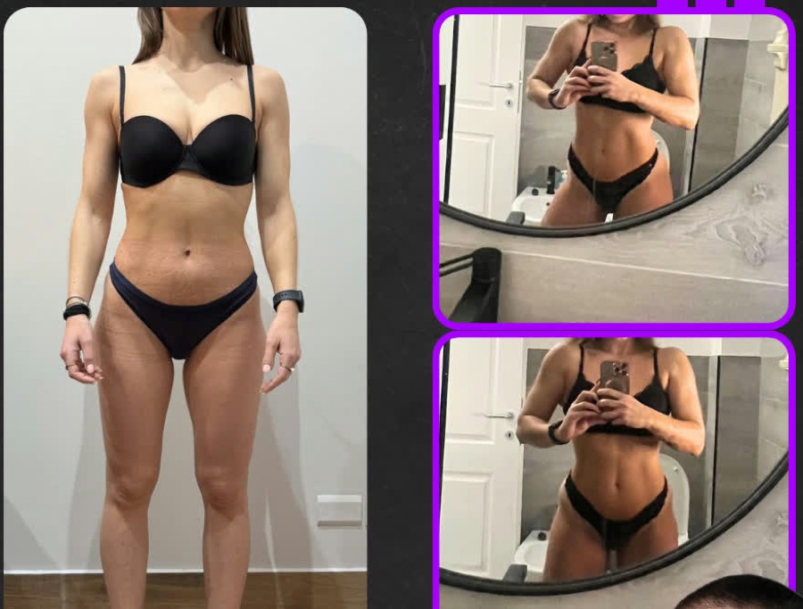 Prima e dopo: 9 mesi di nutrizione e coaching: 6 kg in più di massa magra, con stimoli allenanti ridotti e più qualitativi.
