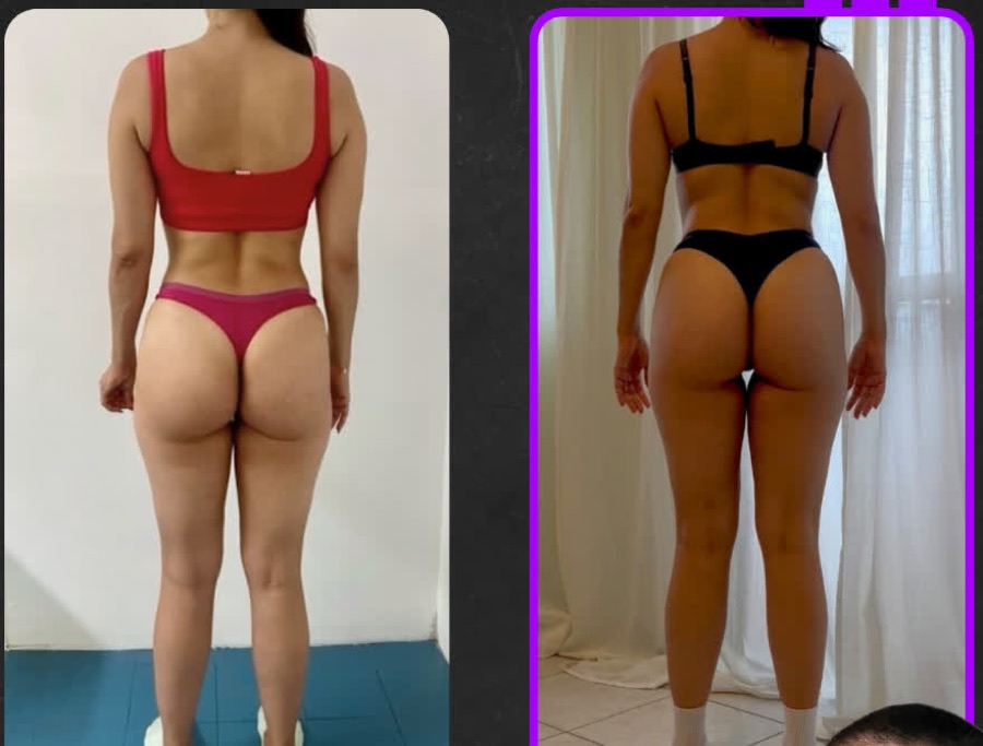 Prima e dopo: Nutrizione e coaching con focus sull'intestino: assorbimenti migliorati e massa magra aumentata su tutto il corpo.